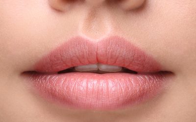 What Are Lip Fillers and How Do They Work?